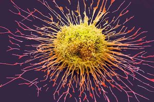 سرطان چگونه بوجود می آید ، انواع سرطان و روش های درمان ؟