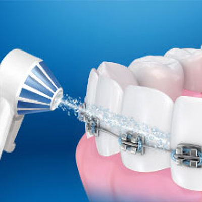 OralB Aquacare4 - واترجت دندان اورال بی Oral B مدل Aquacare 4